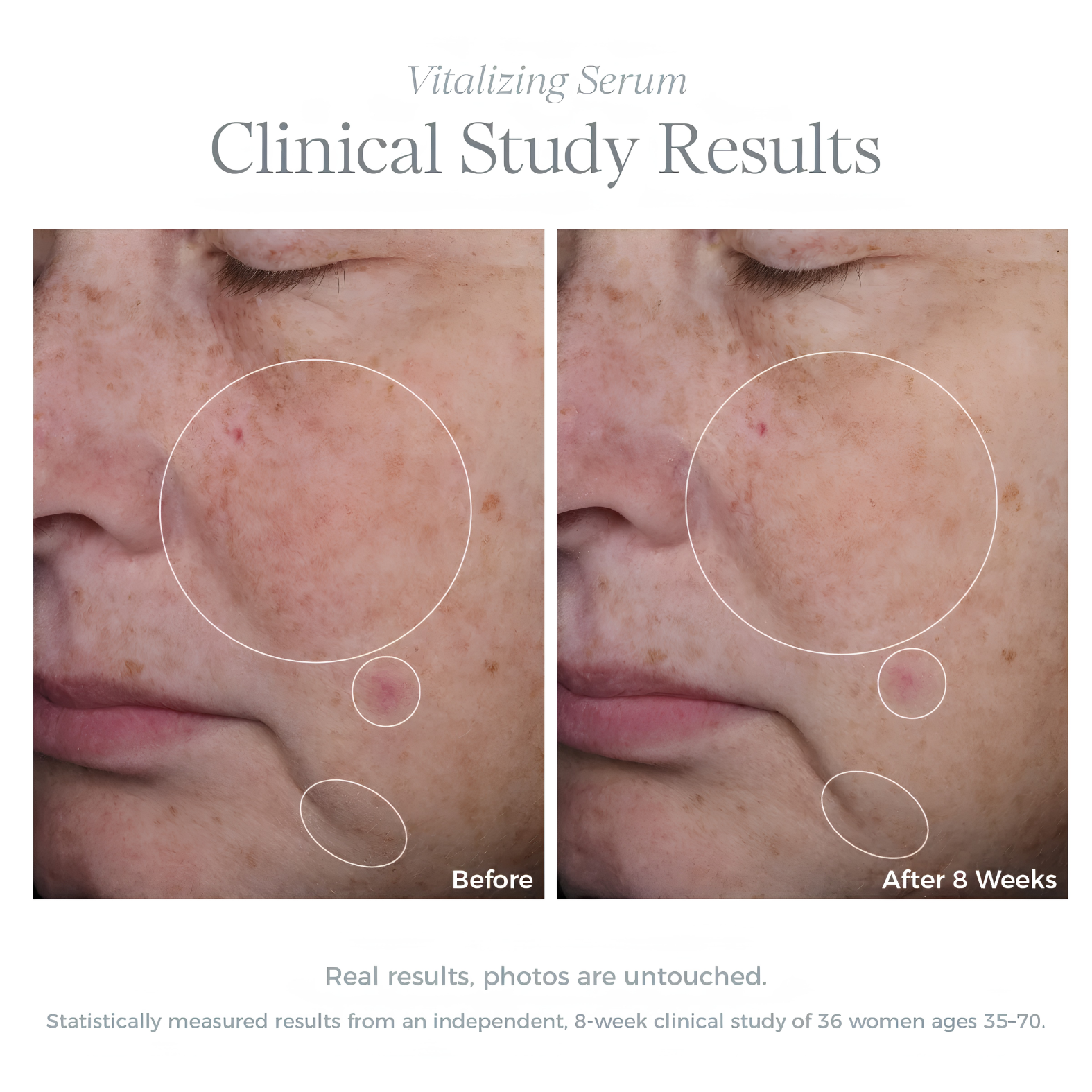 Vitalizing Serum